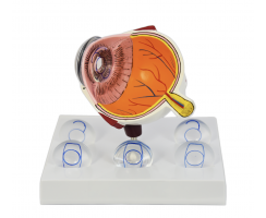 Intraocular Eye Model