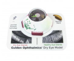 Dry Eye Model