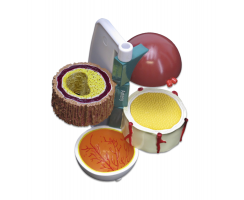 DIABETES EYE-PLUS MODEL